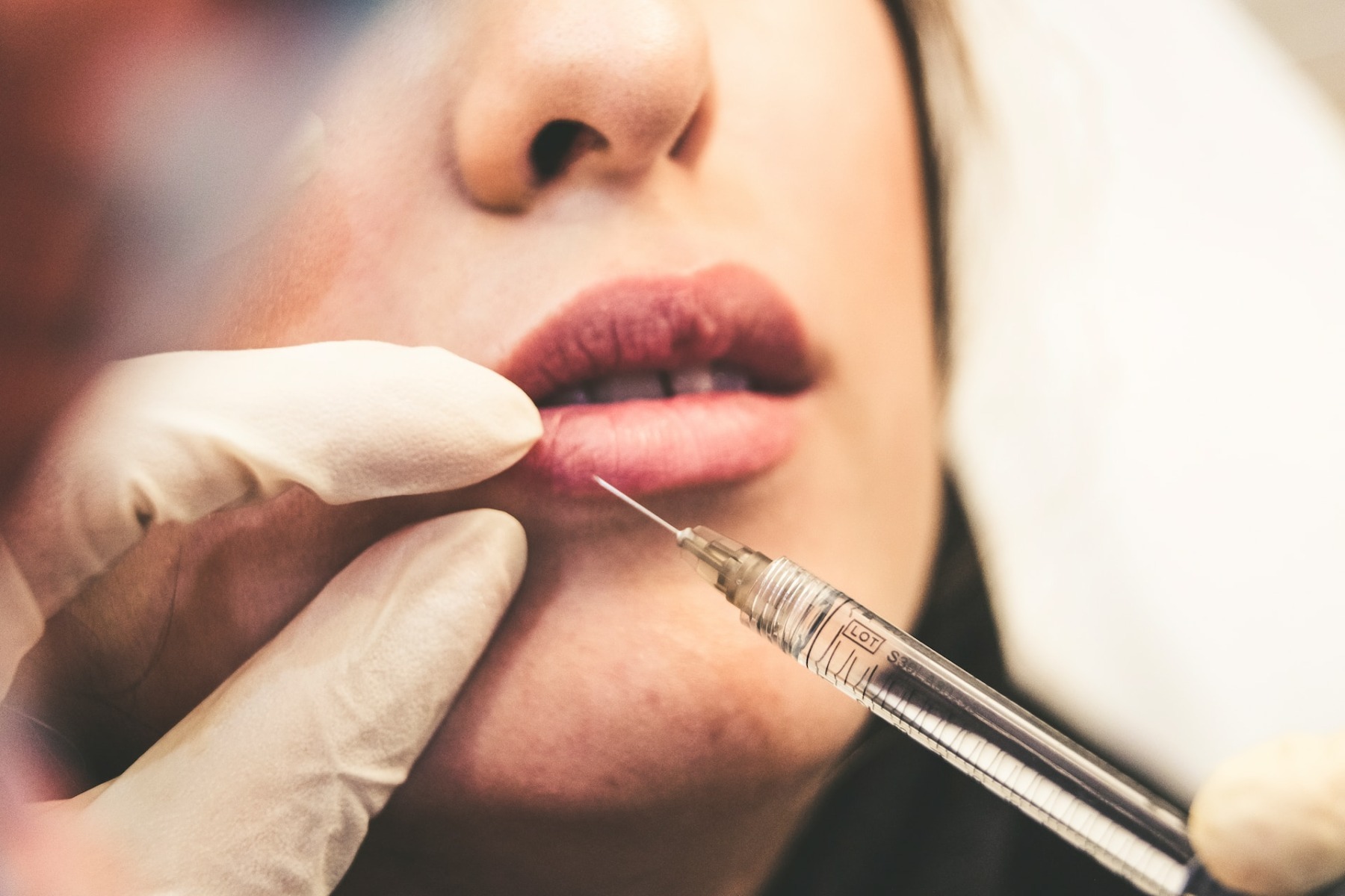 16 persoane au ajuns la Urgențe în provincia turcă Antalya în urma unor injecții cu Botox făcute de persoane neautorizate
